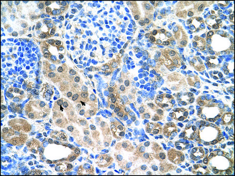 Anti-SLC22A7 (AB1) antibody produced in rabbit affinity isolated antibody