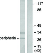 Anti-PGP9.5 antibody produced in rabbit affinity isolated antibody
