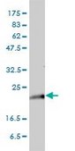 Monoclonal Anti-KRAS antibody produced in mouse clone 3B10-2F2, purified immunoglobulin, buffered aqueous solution