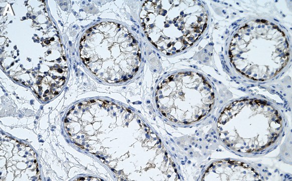 Anti-ATG16L Antibody, clone 1I5 ZooMAb&#174; Rabbit Monoclonal recombinant, expressed in HEK 293 cells