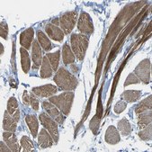 Anti-RHOT2 antibody produced in rabbit Prestige Antibodies&#174; Powered by Atlas Antibodies, affinity isolated antibody, buffered aqueous glycerol solution