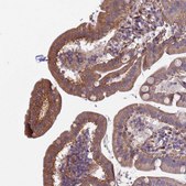 Anti-ITGB4 antibody produced in rabbit Prestige Antibodies&#174; Powered by Atlas Antibodies, affinity isolated antibody, buffered aqueous glycerol solution