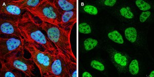 Anti-NCOA1 Antibody, clone 5B9, ZooMAb&#174; Rabbit Monoclonal recombinant, expressed in HEK 293 cells