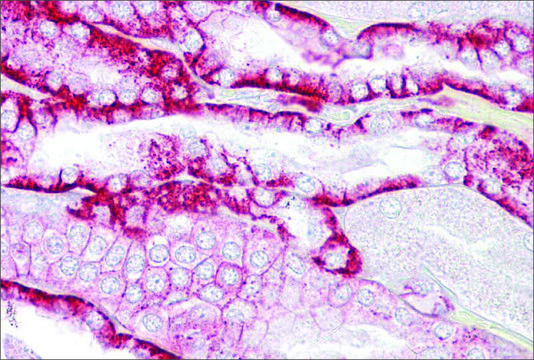 Anti-CDH16 antibody produced in rabbit affinity isolated antibody