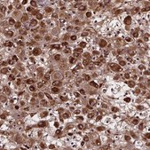 Anti-AEBP1 antibody produced in rabbit Prestige Antibodies&#174; Powered by Atlas Antibodies, affinity isolated antibody, buffered aqueous glycerol solution