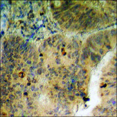 Anti-phospho-ETS1 (pThr38) antibody produced in rabbit affinity isolated antibody