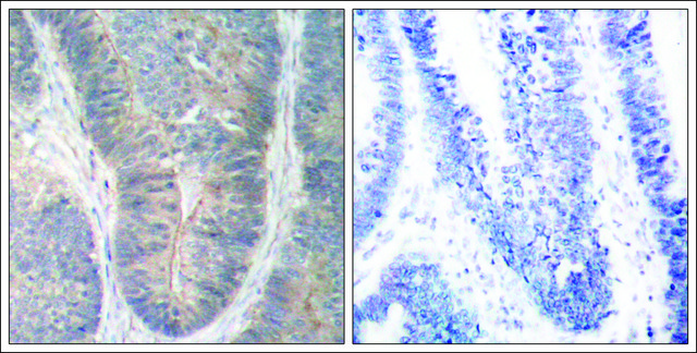 Anti-phospho-EIF2AK2 (pThr451) antibody produced in rabbit affinity isolated antibody