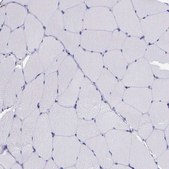 Anti-AHNAK2 antibody produced in rabbit Prestige Antibodies&#174; Powered by Atlas Antibodies, affinity isolated antibody, buffered aqueous glycerol solution
