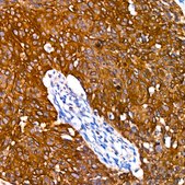 Anti-Cytokeratin 14 (KRT14) Antibody, clone 5Z4O9, Rabbit Monoclonal