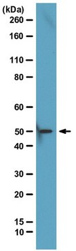 ChIPAb+ EED - ChIP Validated Antibody and Primer Set from mouse