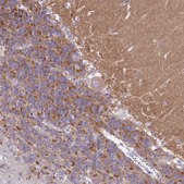 Anti-KCNC1 antibody produced in rabbit Prestige Antibodies&#174; Powered by Atlas Antibodies, affinity isolated antibody, buffered aqueous glycerol solution