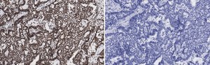 Anti-p-ATM (Ser1981) Antibody, clone 1E19, ZooMAb&#174; Rabbit Monoclonal recombinant, expressed in HEK 293 cells