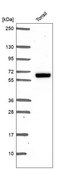 Anti-Esr2 Antibody Produced In Rabbit Prestige Antibodies&#174; Powered by Atlas Antibodies, affinity isolated antibody, buffered aqueous glycerol solution
