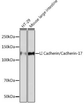 Anti-LI Cadherin/Cadherin-17 Antibody, clone 9X2S3, Rabbit Monoclonal