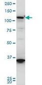 Monoclonal Anti-HIP1R antibody produced in mouse clone 3E10, ascites fluid