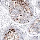 Monoclonal Anti-CT83 antibody produced in mouse Prestige Antibodies&#174; Powered by Atlas Antibodies, clone CL4762, purified immunoglobulin
