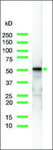 Anti-Vimentin antibody, Rabbit monoclonal recombinant, expressed in proprietary host, clone SP20, tissue culture supernatant