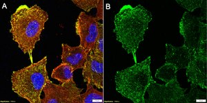 Anti-&#945;-Actinin 4 Antibody, clone 1D9 ZooMAb&#174; Rabbit Monoclonal recombinant, expressed in HEK 293 cells