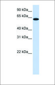 Anti-TYRP1 antibody produced in rabbit affinity isolated antibody