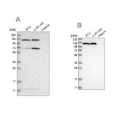 Anti-ACLY antibody produced in rabbit Prestige Antibodies&#174; Powered by Atlas Antibodies, affinity isolated antibody, buffered aqueous glycerol solution