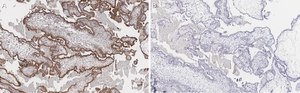 Anti-FAK Antibody, clone 1D14 ZooMAb&#174; Rabbit Monoclonal recombinant, expressed in HEK 293 cells