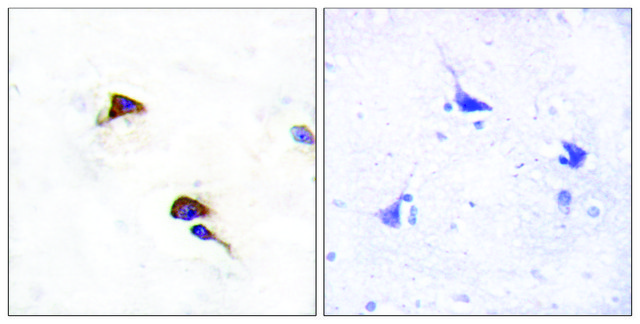 Anti-PPIF antibody produced in rabbit affinity isolated antibody