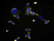 MOC22 Mouse Oral Squamous Cell Carcinoma (OSCC) Cell Line