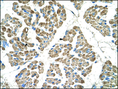 Anti-SLC22A7 (AB2) antibody produced in rabbit IgG fraction of antiserum