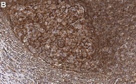 Anti-OAS1 Antibody, clone 1N2 ZooMAb&#174; Rabbit Monoclonal recombinant, expressed in HEK 293 cells