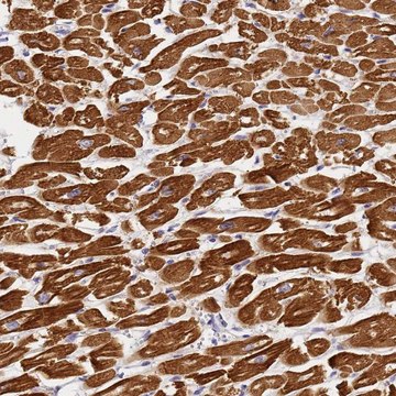 Anti-MYL2 antibody produced in rabbit Prestige Antibodies&#174; Powered by Atlas Antibodies, affinity isolated antibody, buffered aqueous glycerol solution