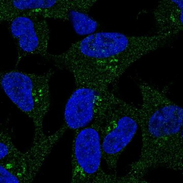 Anti-DKK2 antibody produced in rabbit Prestige Antibodies&#174; Powered by Atlas Antibodies, affinity isolated antibody