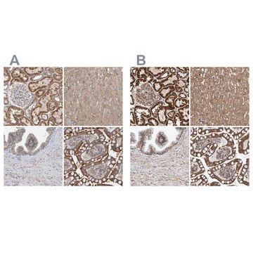 Anti-MRPL45 antibody produced in rabbit Prestige Antibodies&#174; Powered by Atlas Antibodies, affinity isolated antibody, buffered aqueous glycerol solution, Ab2