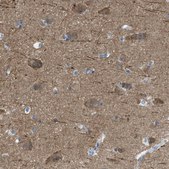 Anti-FAIM2 antibody produced in rabbit Prestige Antibodies&#174; Powered by Atlas Antibodies, affinity isolated antibody, buffered aqueous glycerol solution