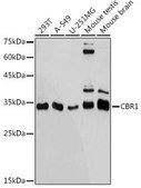 Anti-CBR1 antibody produced in rabbit