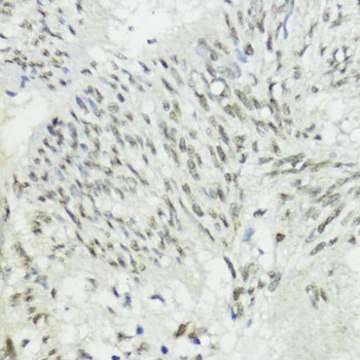 Anti- ZEB1 antibody produced in rabbit