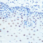 Anti-CDK9 antibody produced in rabbit