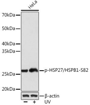 Anti-Phospho-HSP27/HSPB1-S82 antibody produced in rabbit