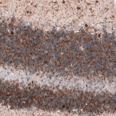 Monoclonal Anti-MAP2 antibody produced in mouse Prestige Antibodies&#174; Powered by Atlas Antibodies, clone CL5420, purified immunoglobulin, buffered aqueous glycerol solution