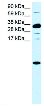 Anti-CXCL1 antibody produced in rabbit affinity isolated antibody