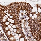 Anti-ATP5A1 antibody produced in rabbit Prestige Antibodies&#174; Powered by Atlas Antibodies, affinity isolated antibody, buffered aqueous glycerol solution