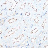 Anti-SSTR5 antibody produced in rabbit