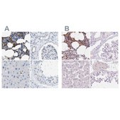 Anti-SERPINB1 antibody produced in rabbit Prestige Antibodies&#174; Powered by Atlas Antibodies, affinity isolated antibody, buffered aqueous glycerol solution