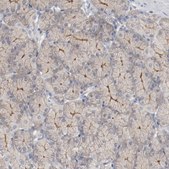 Anti-ADRB2 antibody produced in rabbit Prestige Antibodies&#174; Powered by Atlas Antibodies, affinity isolated antibody, buffered aqueous glycerol solution