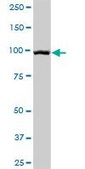 Anti-DSG1 antibody produced in mouse purified immunoglobulin, buffered aqueous solution