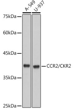 Anti-CCR2/CKR2 Antibody, clone 10L1L6, Rabbit Monoclonal
