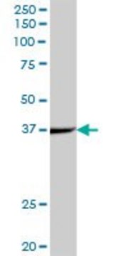 Anti-ACADS antibody produced in mouse IgG fraction of antiserum, buffered aqueous solution