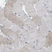 Anti-CUL4B antibody produced in rabbit Prestige Antibodies&#174; Powered by Atlas Antibodies, affinity isolated antibody, buffered aqueous glycerol solution