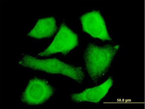 Anti-STIP1 antibody produced in mouse purified immunoglobulin, buffered aqueous solution