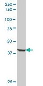Anti-KRT19 antibody produced in mouse IgG fraction of antiserum, buffered aqueous solution