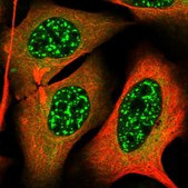 Anti-TAB1 antibody produced in rabbit Prestige Antibodies&#174; Powered by Atlas Antibodies, affinity isolated antibody, buffered aqueous glycerol solution